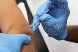 puncion seca indiva vigo