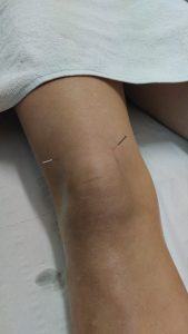 tecnicas orientales vigo masaje